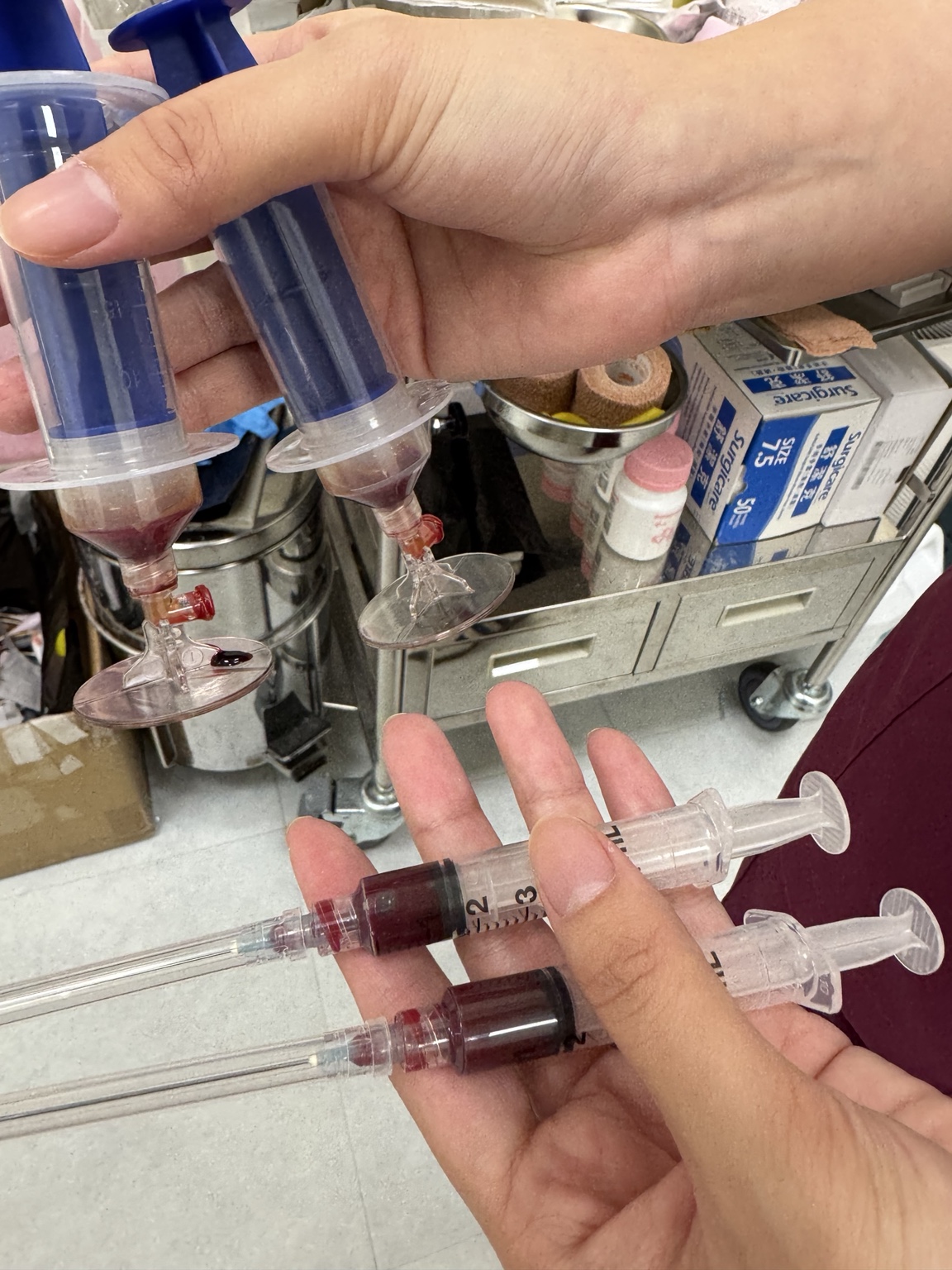 吳浩瑋醫師此次 PRP 治療的製備與注射器實拍紀錄
